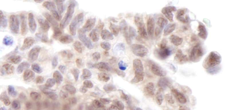 Polyclonal Rabbit anti-Human MLLT3 / AF9 Antibody (aa250-300, IHC)