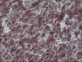 SULT1A1 / Sulfotransferase 1A1 Antibody (clone OTI5A1)