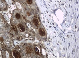 Monoclonal Mouse anti-Human WFDC2 / HE4 Antibody (clone OTI1E12, aa31-124, IHC, WB)