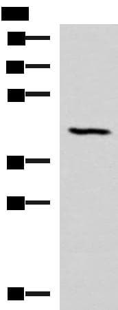 Polyclonal Rabbit anti-Human SMPD2 Antibody (IHC, WB)
