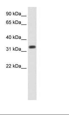 SIAH1 Antibody (aa191-240)