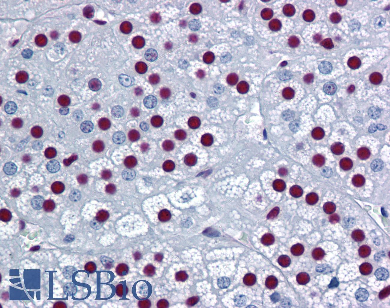 PathPlus™ Monoclonal Mouse anti-Human SF1 Antibody (clone 2E12, IHC, IF, WB)