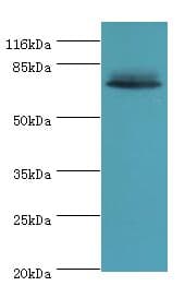 Polyclonal Rabbit anti-Human LHCGR / LHR / LH Receptor Antibody (aa27-362, WB)