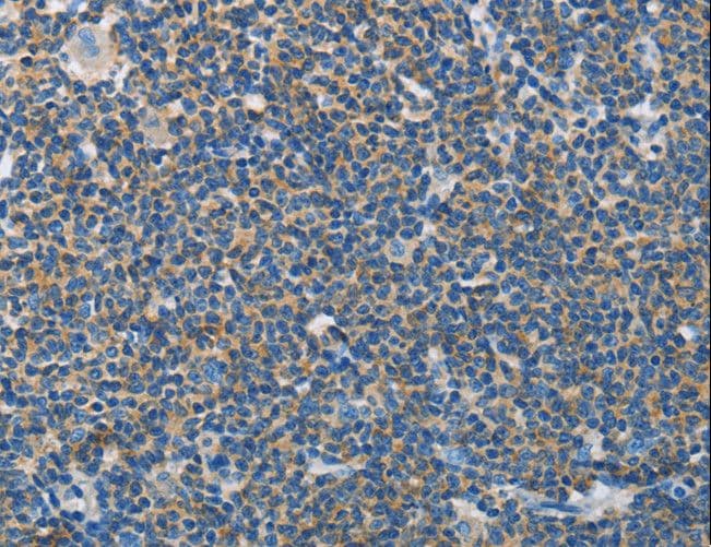 NEK5 Antibody