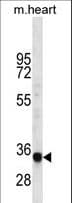 LIX1L Antibody (aa160-189)