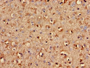Polyclonal Rabbit anti-Human SCG10 / STMN2 Antibody (IHC, IF)