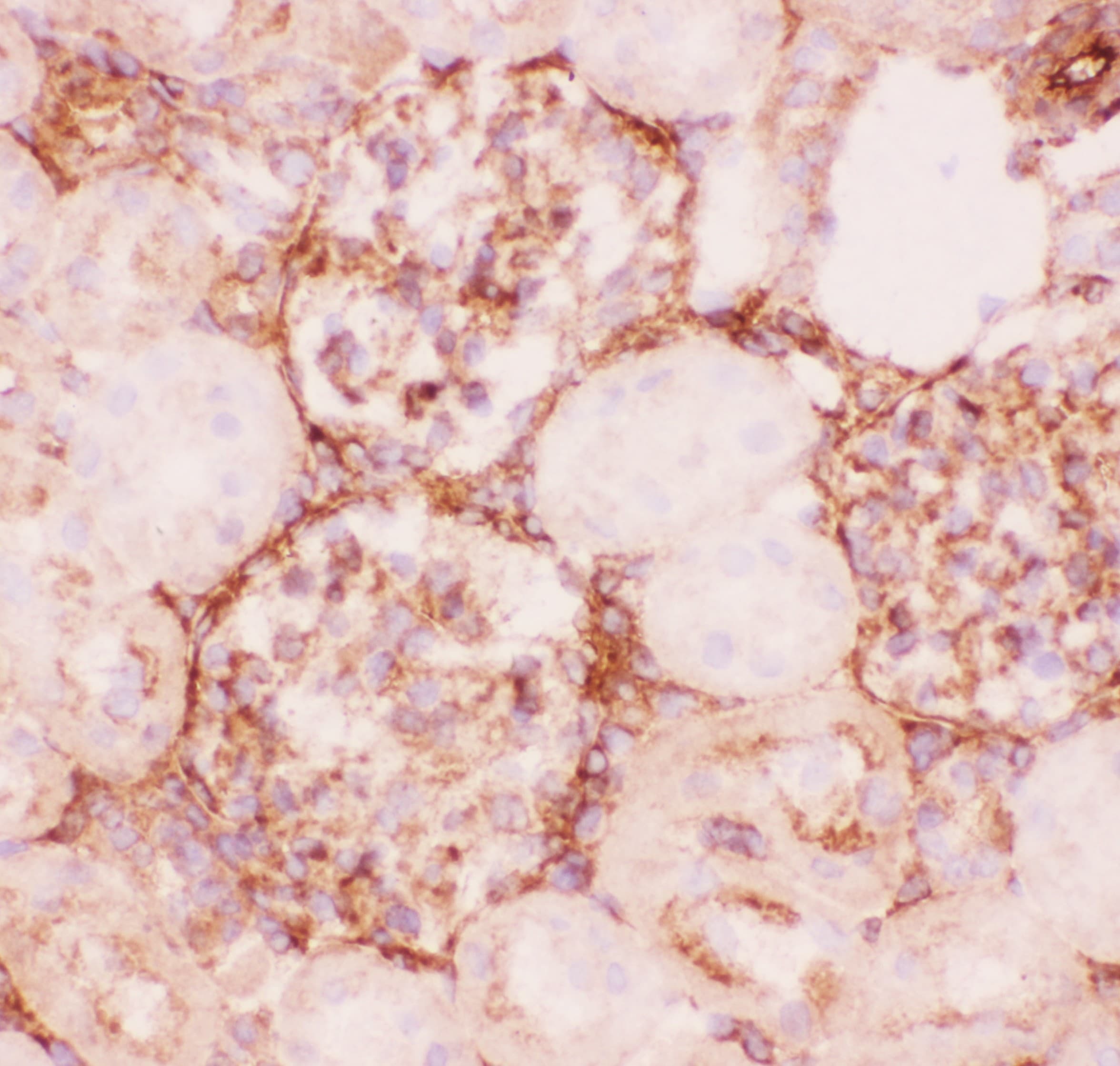 ABCB1 / MDR1 / P Glycoprotein Antibody (aa621-650)