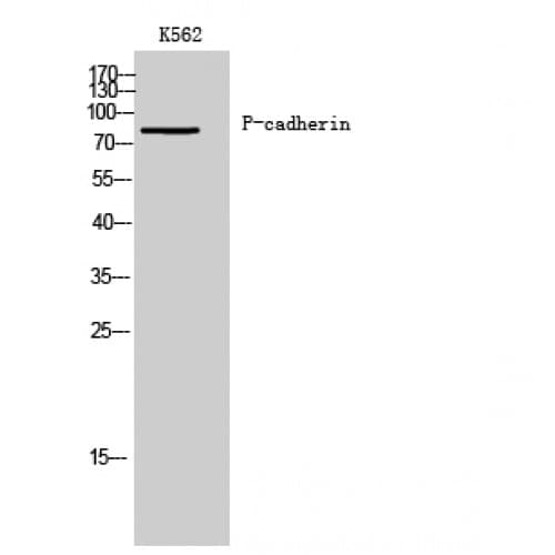 CDH3 / P-Cadherin Antibody (30-110 aa, N-terminal)