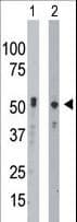 BCKDK Antibody (aa325-356)