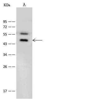 B1R / BDKRB1 Antibody