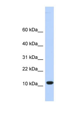 TMEM254 / C10orf57 Antibody (aa36-85)