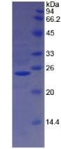 Sheep HBB / Hemoglobin Beta Protein (Recombinant His-S)
