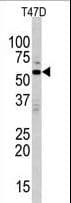 MAPK15 / ERK7 Antibody (aa32-61)