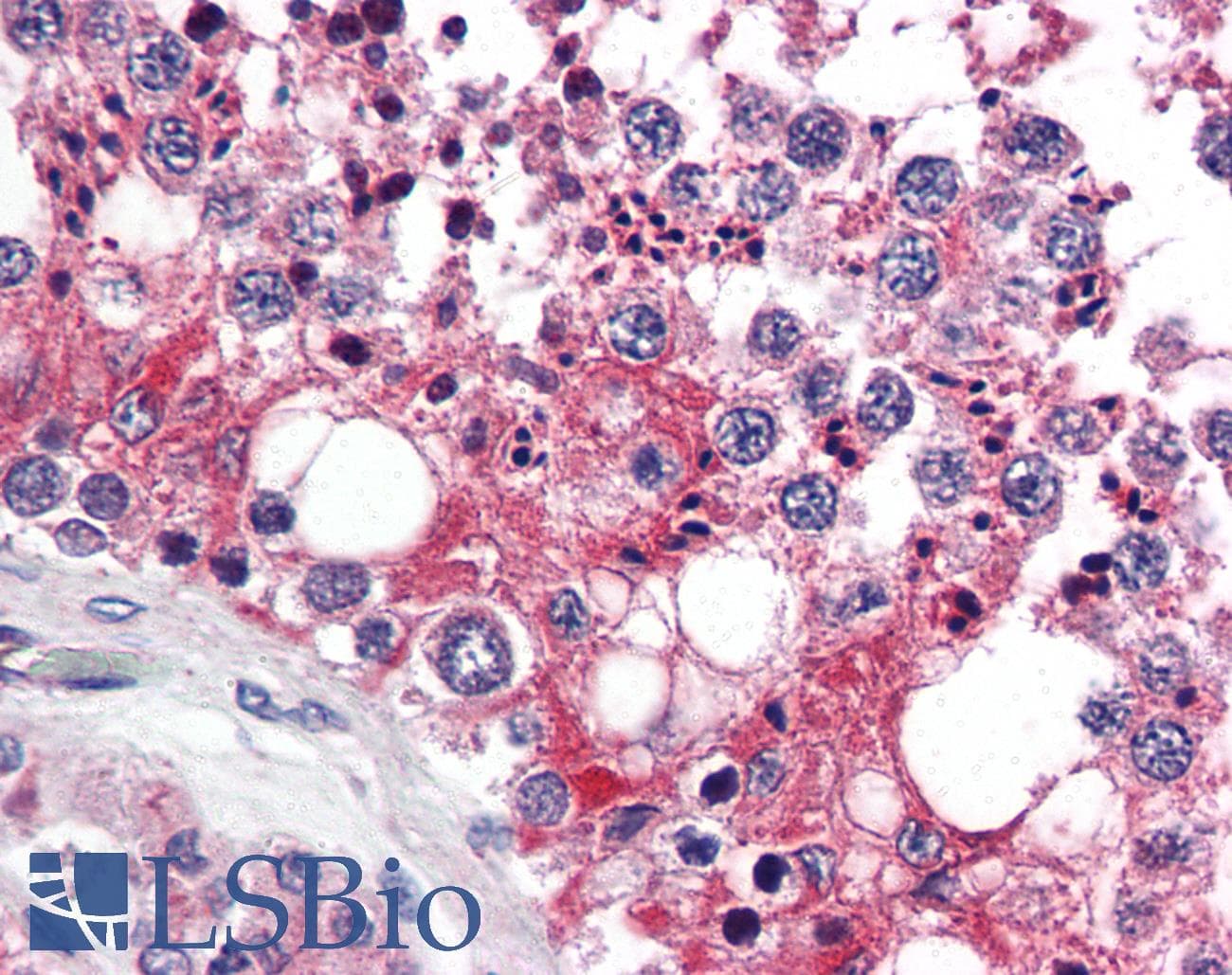IHC-plus™ UIMC1 / RAP80 Antibody