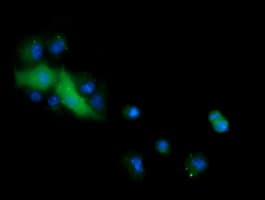 CTAG1B / NY-ESO-1 Antibody (clone OTI4D8)