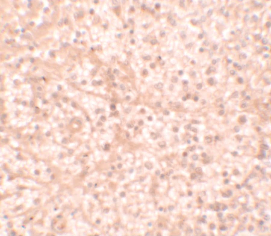 IL17RA Antibody