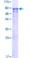 Human SEC31A / HSPC275 Protein (Recombinant GST)