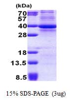 Human CDK3 Protein (Recombinant His)