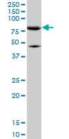 Monoclonal Mouse anti-Human Mitofusin 2 / MFN2 Antibody (clone 6A8, IHC, WB)