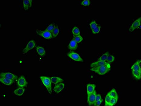 MTTP / MTP Antibody
