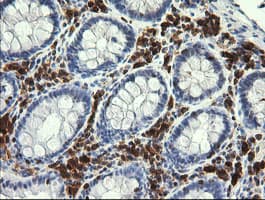 PIK3CG / PI3K Gamma Antibody (clone OTI4D3)