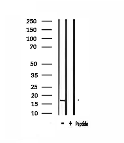 RPS13 / Ribosomal Protein S13 Antibody