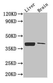 Polyclonal Rabbit anti-Human CXCR4 Antibody (IHC, WB)