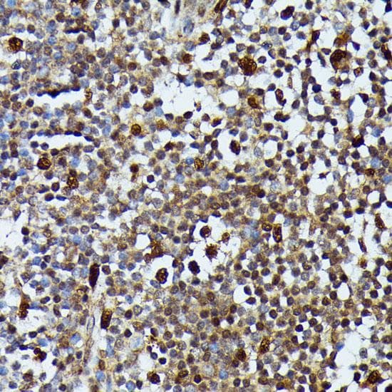 MAP3K3 / MEKK3 Antibody