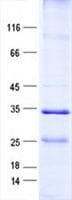Human EMCN / Endomucin Protein (Recombinant His, N-Terminal)