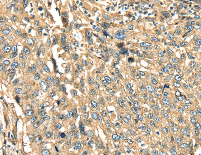 Polyclonal Rabbit anti-Human ANXA2 / Annexin A2 Antibody (IHC, WB)