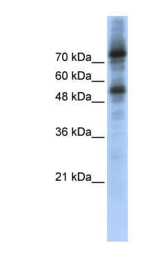 Polyclonal Rabbit anti-Human FOXM1 Antibody (C-Terminus, WB)