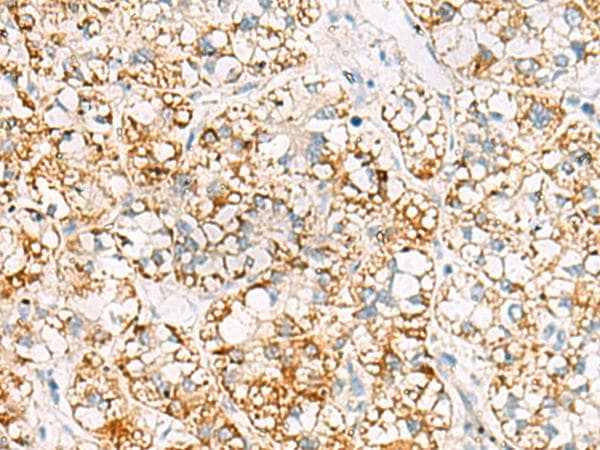 MRPL20 Antibody
