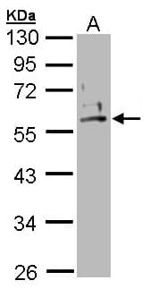 KRT2 / CK2 / Cytokeratin 2 Antibody (aa143-529)