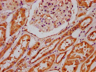 Polyclonal Rabbit anti-Human VARS2 / ValRS Antibody (IHC)