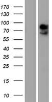 SLC16A2 / MCT8 Protein (Over-Expression Lysate Myc-DDK (Flag))