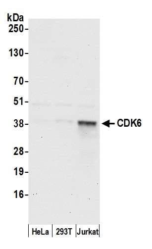 CDK6 Antibody (aa250-300)