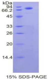 Human CDH1 / E Cadherin Protein (Recombinant His-S)