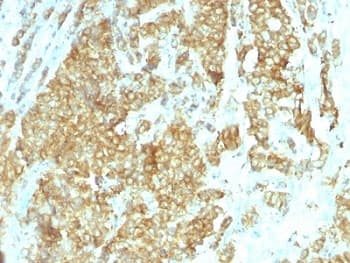 HSP90B1 / GP96 / GRP94 Antibody (clone HSP90B1/1192)