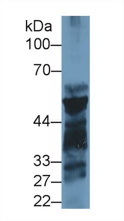 PNLIP / PL / Pancreatic Lipase Antibody (aa47-280)
