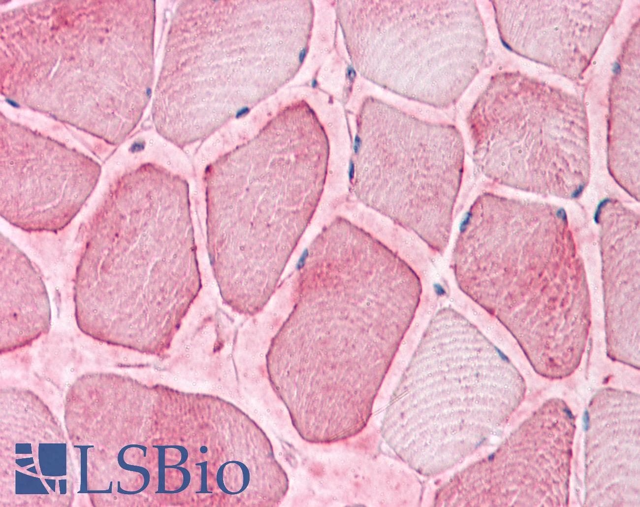 IHC-plus™ Polyclonal Rabbit anti-Human SEMA4B / Semaphorin 4B Antibody (Internal, IHC)