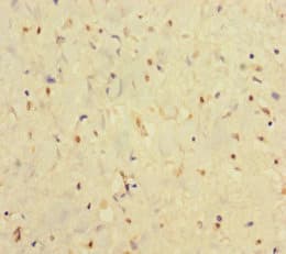 IFNAR2 Antibody (aa27-243)
