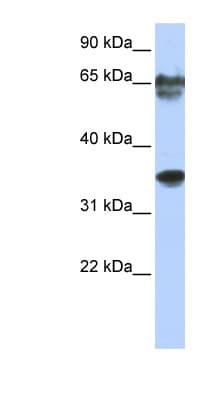 NKX3-2 / BAPX1 Antibody (N-Terminus)
