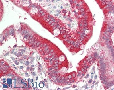 IHC-plus™ Polyclonal Rabbit anti-Human PDCD6IP / ALIX Antibody (aa818-868, IHC, WB)