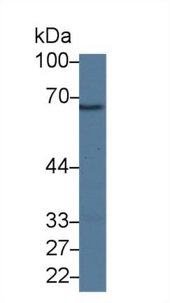 CFI / Complement Factor I Antibody (aa358-603)
