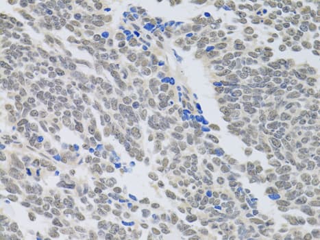 PAX3 Antibody