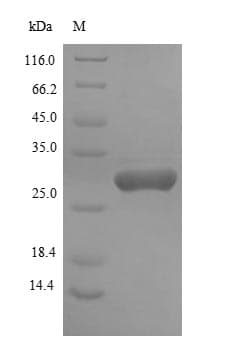 Prevotella intermedia PHOA Protein (Recombinant 10His-GST, N-terminus + Myc, C-terminus)