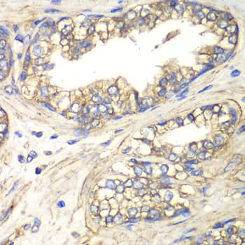 IHC-plus™ SLC4A4 / NBC1 Antibody
