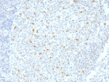 Monoclonal Mouse anti-Human BCL6 Antibody (clone BCL6/1526, IHC, IF)