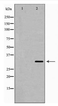 Polyclonal Rabbit anti-Human FASLG / Fas Ligand Antibody (IHC, WB)