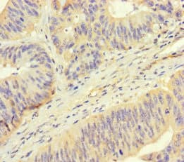ROPN1 / Ropporin Antibody